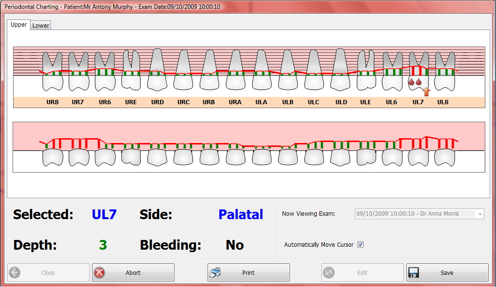 Periodontal charting